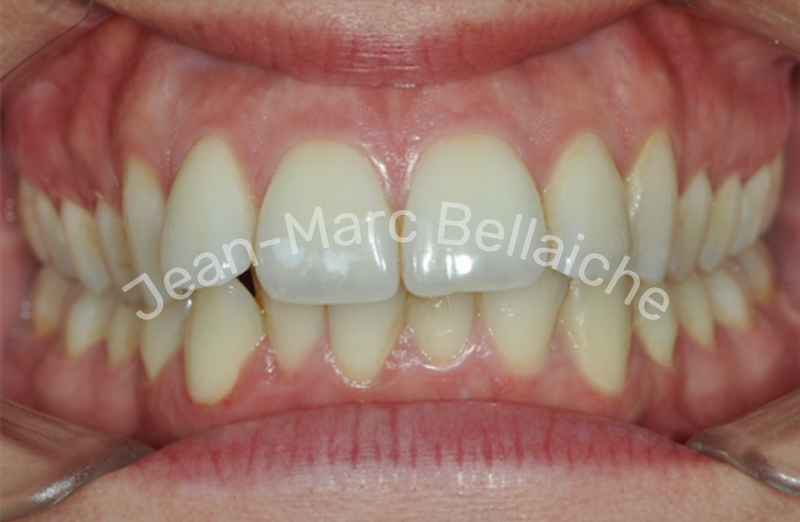 orthodontie montmartre