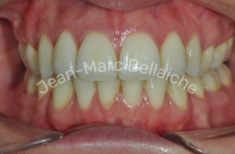 orthodontie montmartre