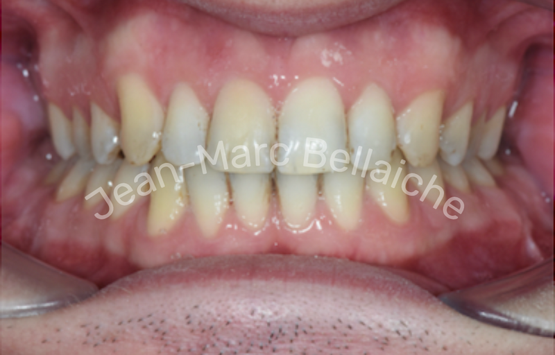 orthodontie montmartre