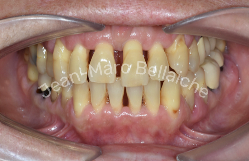 orthodontie montmartre