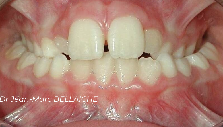 orthodontie paris 18