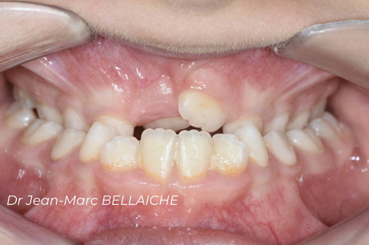 orthodontie montmartre