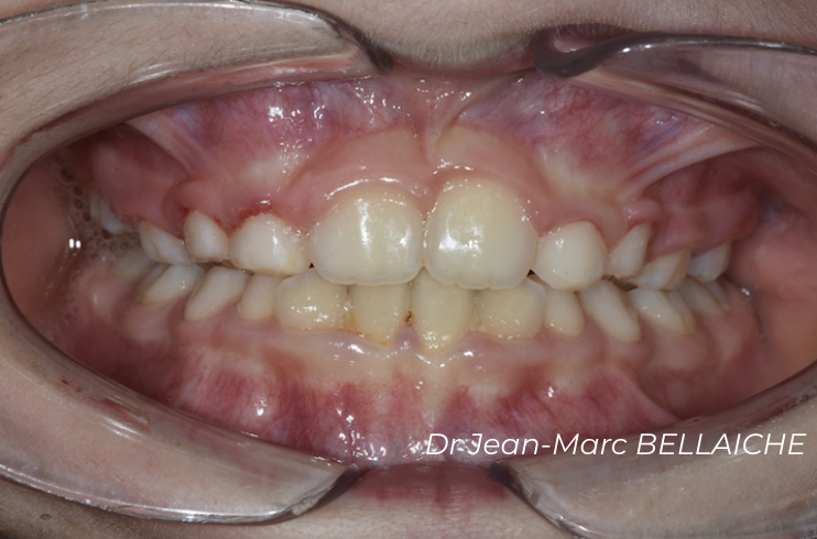 orthodontie montmartre