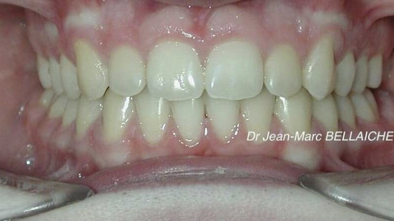 orthodontiste paris 18