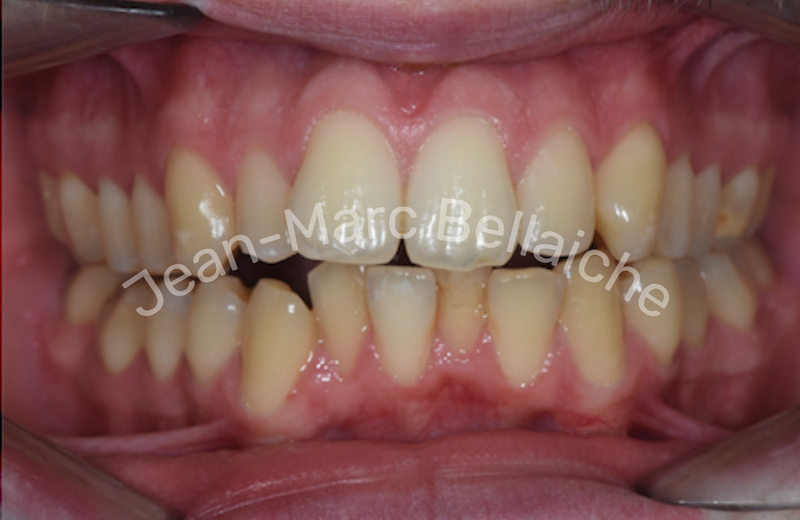 orthodontie montmartre