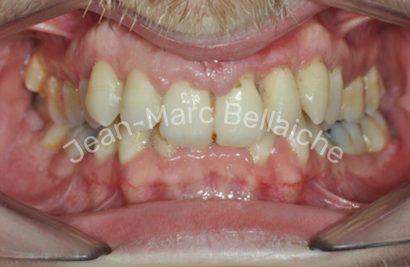 orthodontie montmartre