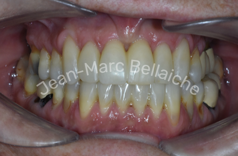 orthodontie montmartre