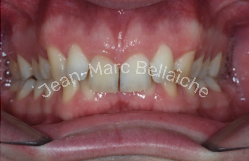 orthodontie montmartre