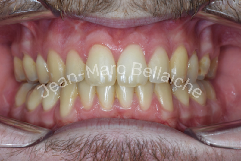 orthodontie montmartre