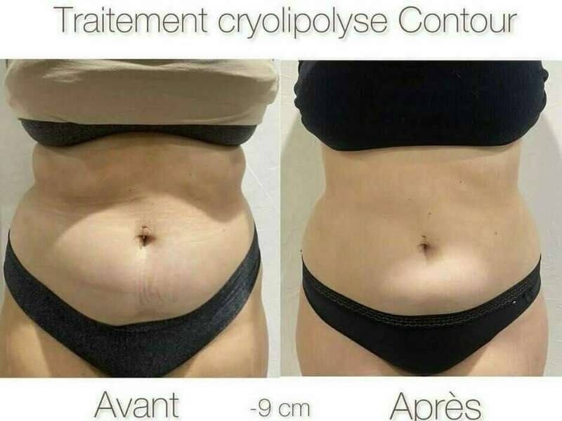 384543142_1366054730936870_2708314807703122001_n