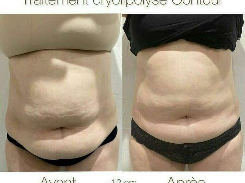 400599278_358990426812917_6055504486115267425_n