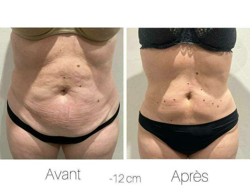 400497801_1827001267757272_6117024179597636956_n