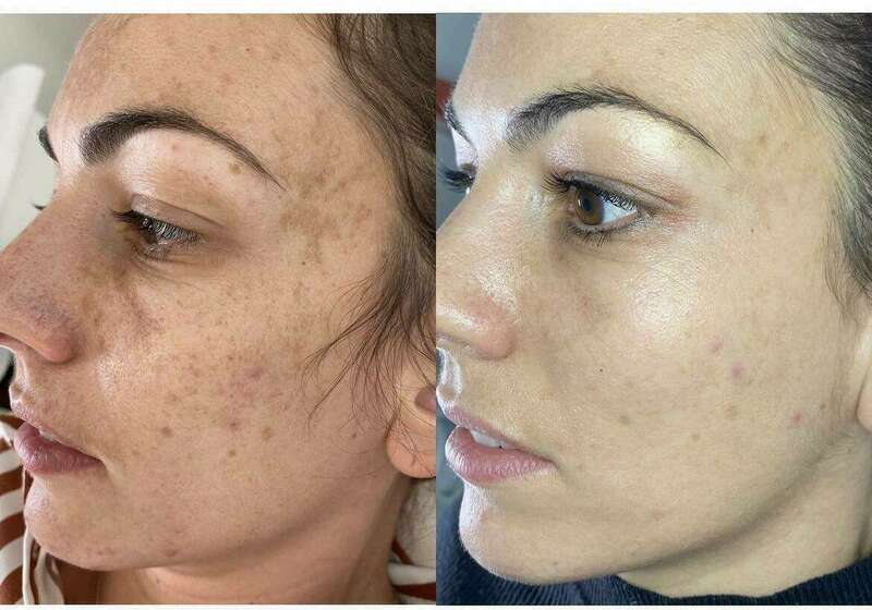 400238682_321487617395852_9064992165199136359_n