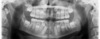 Radio cas clinique d’orthodontie adolescent Le Mans