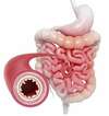 naturopathie et barrière intestinale