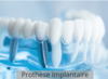 Image prothèse