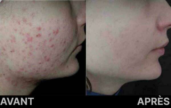 Des techniques avancées pour améliorer votre apparence