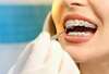 dent traitement orthodontie gouttiere bague osteo osteopathe Suresnes athina