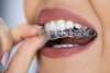 dent traitement orthodontie gouttiere bague osteo osteopathe Suresnes athina
