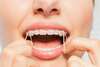 dent traitement orthodontie gouttiere bague osteo osteopathe Suresnes athina