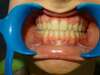 Intrabuccale face - Fin de traitement (15-01-2024) - 53 1