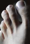 Personne recevant soin des ongles pour onychomycose au salon