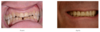 Cas clinique n°21