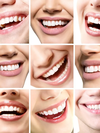 Collage de sourires avec des dents blanches et alignées