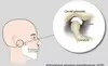 Articulations temporo-mandibulaires (ATM)
