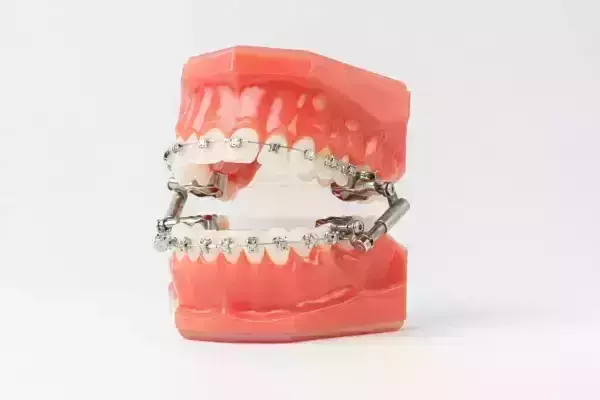 orthodontie_paris_4_dr_shahen