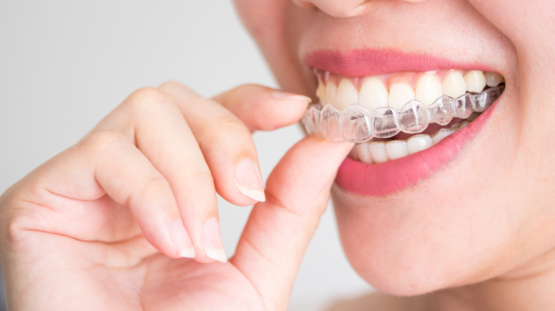 Orthodontie de l'adulte, Dr Karine PERRIN LEFEBVRE à Annemasse (74100)