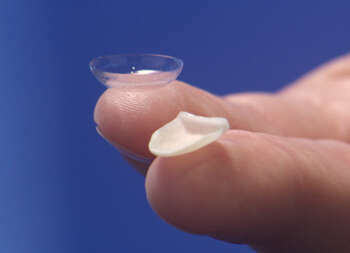 Les facettes Lumineers