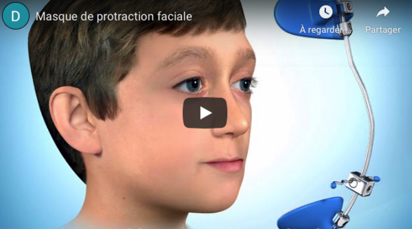 Le masque facial de Delaire