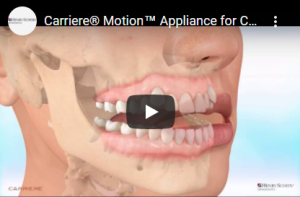 Carriere motion Classe llI