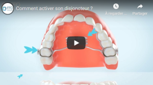 Comment activer son disjoncteur ?