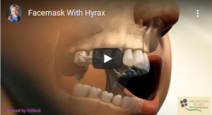 Disjoncteur et masque de Delaire