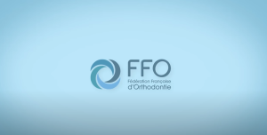 Comment activer son disjoncteur ?