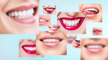 NOS LABORATOIRES DE PROTHÈSES DENTAIRES