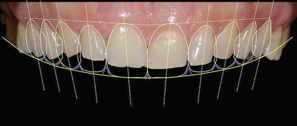 L'ESTHÉTIQUE DU SOURIRE