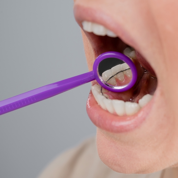 Contention et débaguage - CUERS