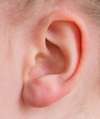 accouphene