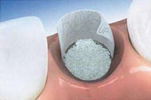 COMPTE-RENDU D'INTERVENTION