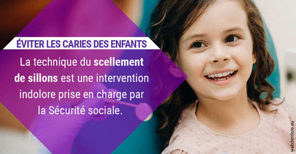 Le scellement de sillons