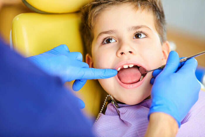 PRÉVENTION DES CARIES : LE SCELLEMENT DES SILLONS CHEZ L’ENFANT