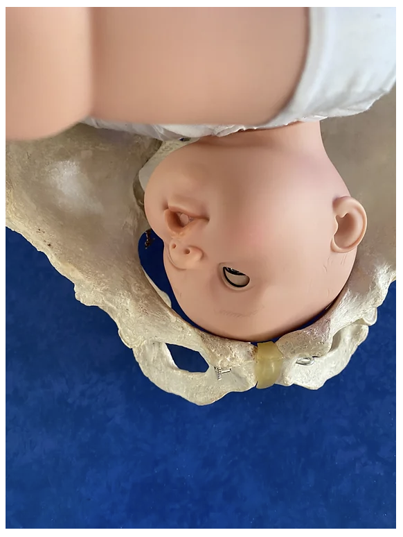 La grossesse en ostéopathie