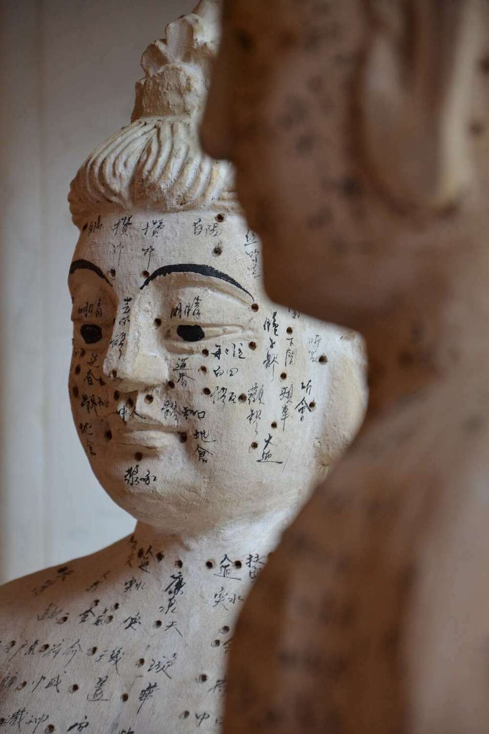 acupuncture medecine chinoise