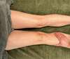 drainage lymphatique renata jambes lourdes osteo paris 12