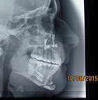 LA CHIRURGIE ORTHOGNATIQUE