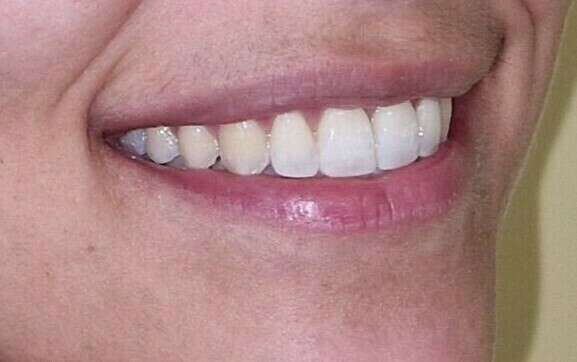 LES PRINCIPALES TECHNIQUES DE TRAITEMENT ORTHODONTIQUE