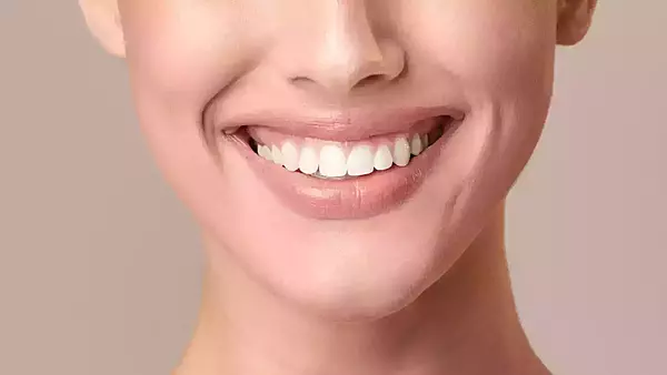 APPAREILS MULTI-ATTACHES EN ORTHODONTIE